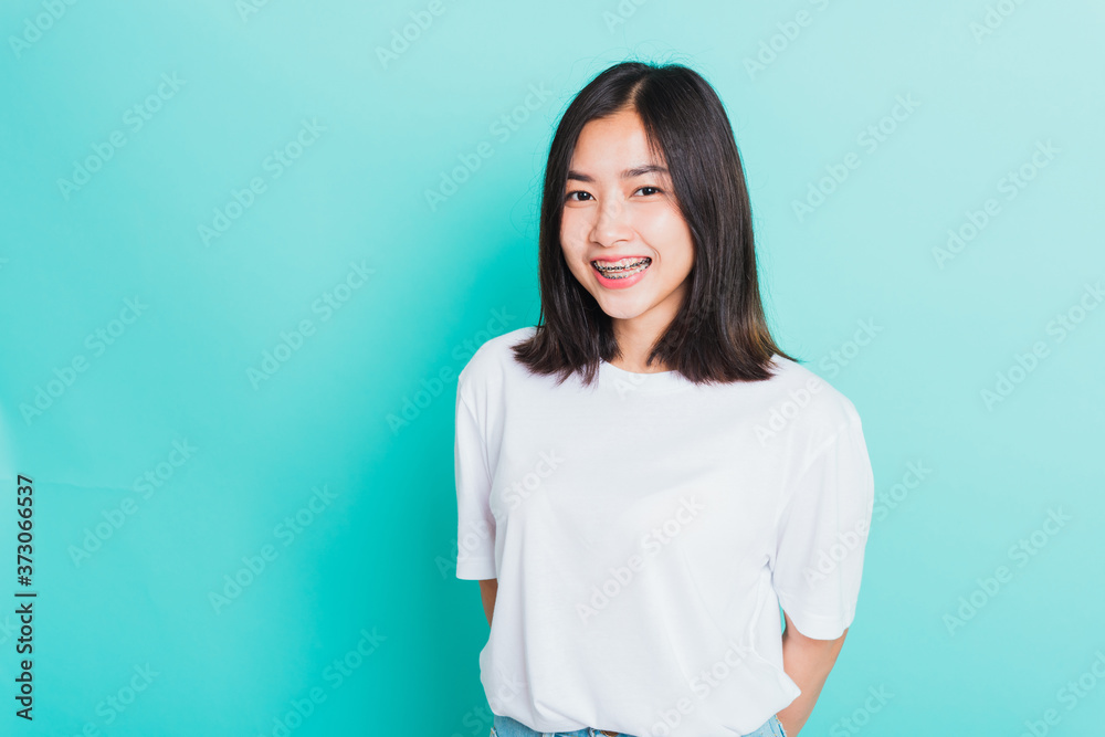 Portrait of teen Asian beautiful young woman smile have dental braces on teeth laughing, studio shot isolated on a blue background, medicine and dentistry female mouth concept Portrait of teen Asian beautiful young woman smile have dental braces on teeth laughing, studio shot isolated on a blue background, medicine and dentistry female mouth concept