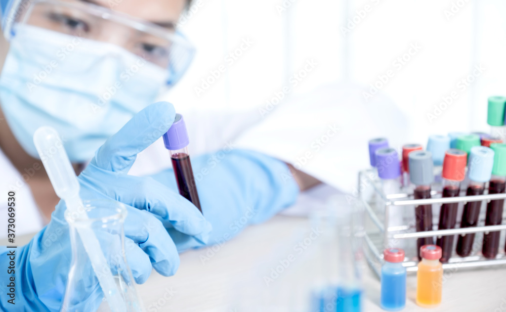 doctor's hand holding a sample blood tube for analysis and test virus disease in the laboratory, This research is plasma biomedicine for diagnostic medical healthcare