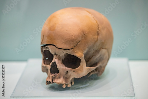 Plastic realistic skull model with damage. Anatomy. Tutorial.