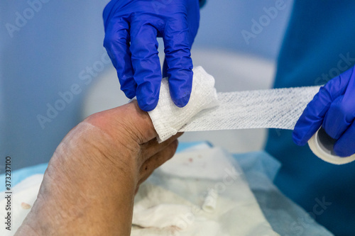 Fotografie Healthcare worker nursing toe with bandage gauz after ingrown toenail surgery