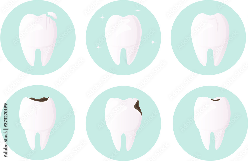 Set of teeth damaged by decay, cracks and chips. Tooth and enamel protection. Daily oral hygiene. Urgent medical dentistry is necessary for the restoration and treatment of teeth. vector flat design
