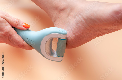 Care and cleansing of the woman feet from rough, flaky skin. An electric foot dead skin remover in a woman's hand grinds foot heel at home.