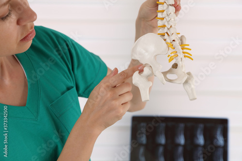 Hip joint pain. Doctor physiotherapist holding human spine model