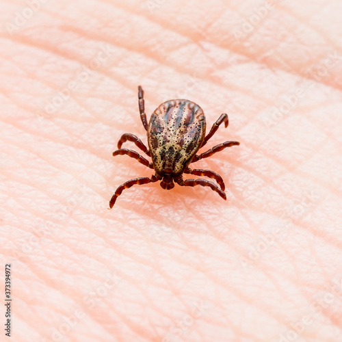 Encephalitis Infected Tick Insect Crawling on Skin. Lyme Borreliosis Disease or Encephalitis Virus Infectious Dermacentor Tick Arachnid Parasite Macro.