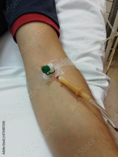 A infusion cannula is inserted into a vein of man's hand