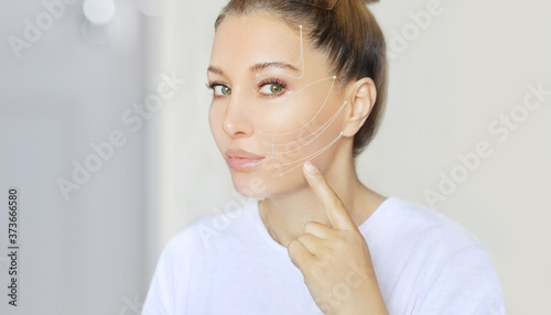 thread lift procedure  non-surgical facelift markup 