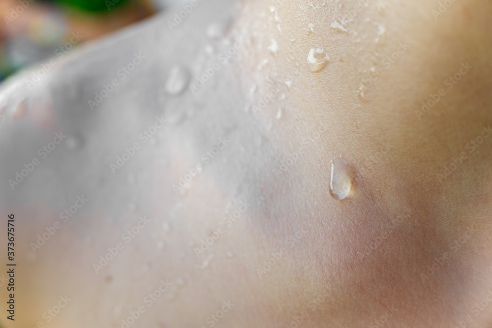 Fototapeta premium Beads of sweat on the skin of a white child.