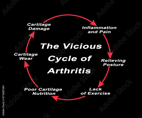 Steps in Vicious Cycle of Arthritis