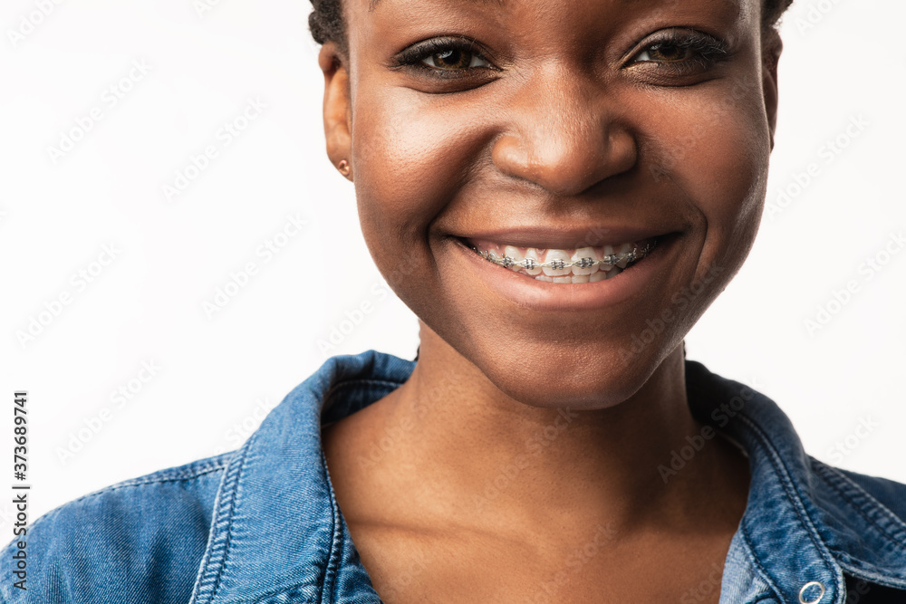 African Girl With Braces Smiling To Camera Over White Background African Girl With Braces Smiling To Camera Over White Background