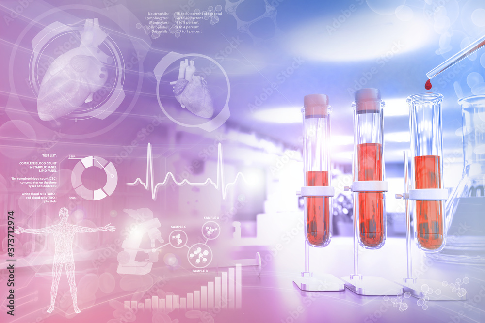 Fototapeta premium Medical 3D illustration, test-tubes vials in study facility - blood analysis for red cell distribution or hiv with creative gradient overlay
