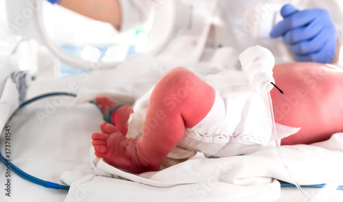 Nurse in blue gloves takes action to monitor and care for premature baby  selective focus. Newborn is placed in the incubator. Neonatal intensive care unit