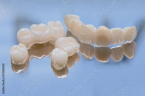 Metal Free Ceramic Dental Crowns. Ceramic zirconium in final version. Staining and glazing. Precision design and high quality materials photo
