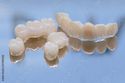 Metal Free Ceramic Dental Crowns. Ceramic zirconium in final version. Staining and glazing. Precision design and high quality materials