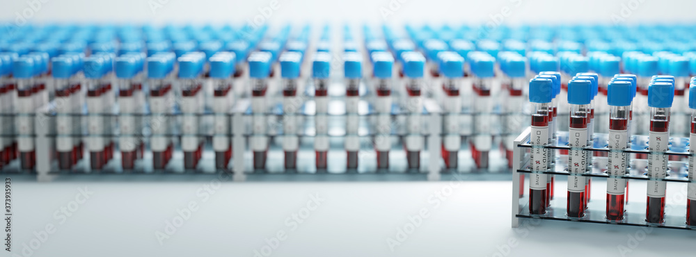 Coronavirus Covid19 test tubes in a rack. Medical screening and Covid tests production