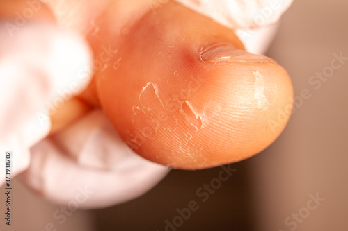 Doctor hand examining an little girl's foot