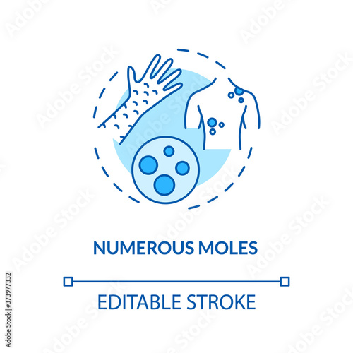 Numerous moles concept icon. Nevus treatment. Skin cancer. Human disease factors. Atypical skin tags idea thin line illustration. Vector isolated outline RGB color drawing. Editable stroke