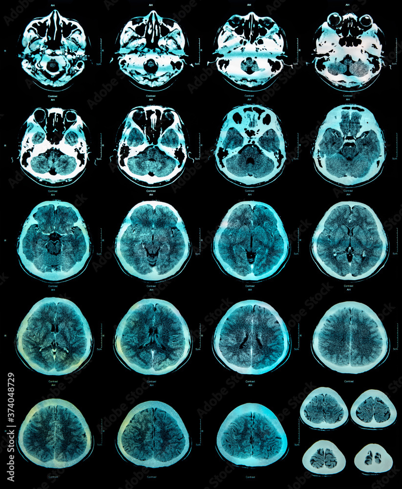 resonance color image (MRI) of the brain. Stock Photo Adobe Stock