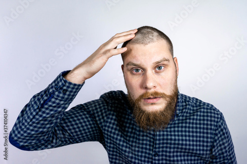 Man with alopecia on head, touching hair. Spot Baldness, Hair fall problem