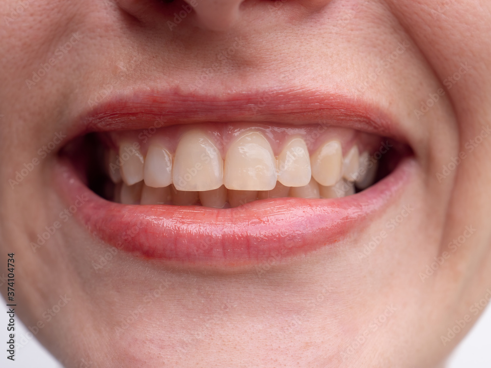 Fototapeta premium Middle aged woman laughs on white background showing perfect white teeth