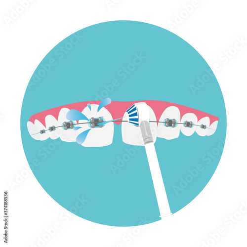 Daily dental care for braces, oral hygiene, orthodontics concept, vector illustration.