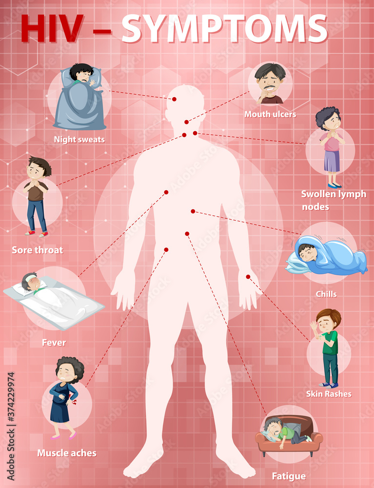Symptoms Of Hiv Infection Infographic Stock Vector Adobe Stock