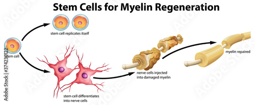 Stem cell for myelin regeneration
