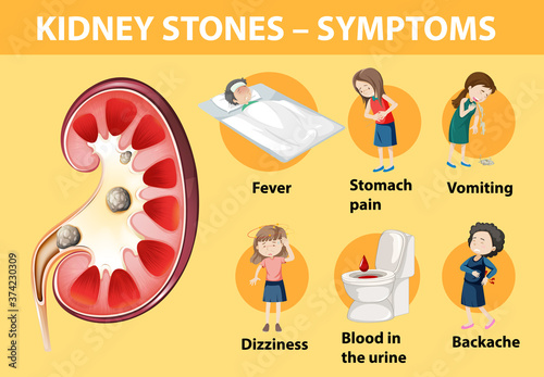 Kidney stones symptoms cartoon style infographic