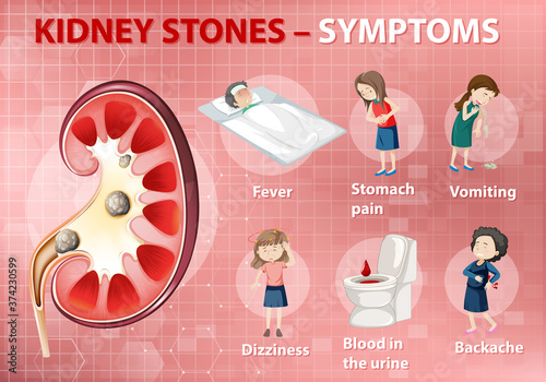Kidney stones symptoms cartoon style infographic