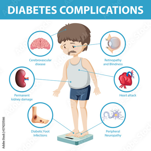 Diabetes complications information infographic