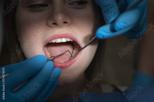 close-up of an open female mouth in bright light in a dark dentist office.