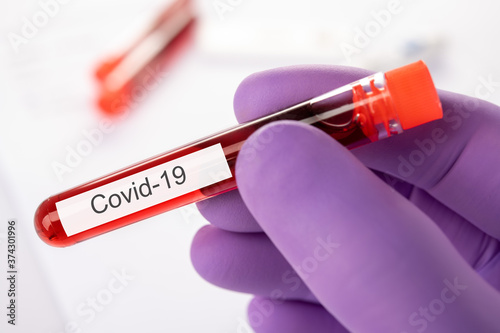 Covid-19 hand in glove and blood test tube