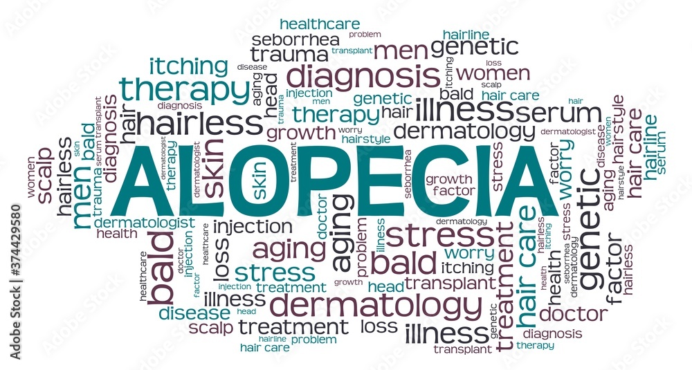 Fototapeta premium Alopecia - hair loss vector illustration word cloud isolated on a white background.