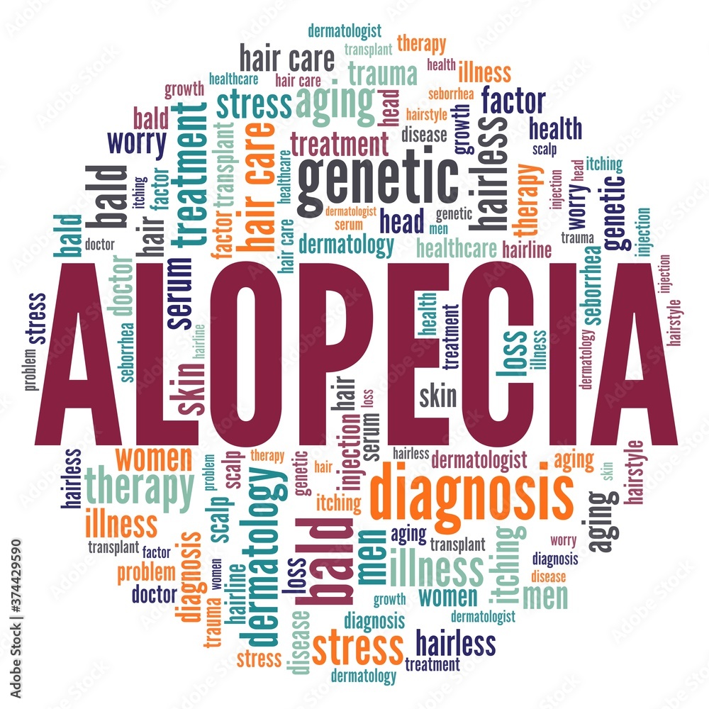Obraz premium Alopecia - hair loss vector illustration word cloud isolated on a white background.