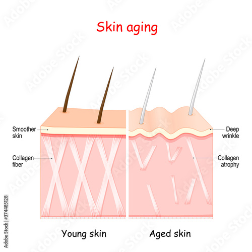 aging process. skin collagen and wrinkles