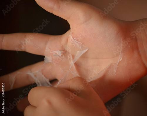Kid peeling hand using liquid white glue 
