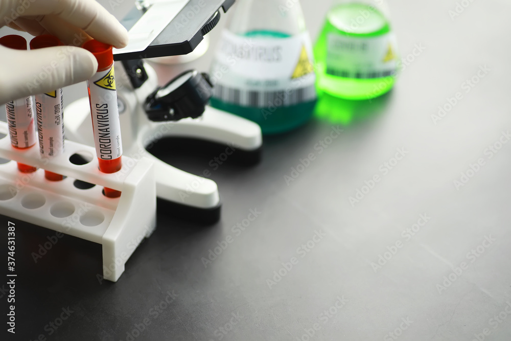 A blood sample for testing the dangerous virus coronavirus in the body. Test tubes with tests for coronavirus. Laboratory studies of viral diseases. A blood sample for testing the dangerous virus coronavirus in the body. Test tubes with tests for coronavirus. Laboratory studies of viral diseases.