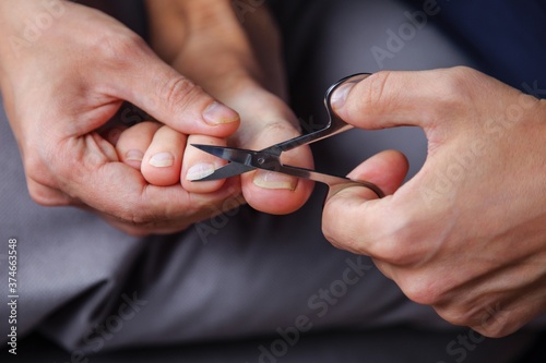 left hand Man shearing his toenails with nail scissors