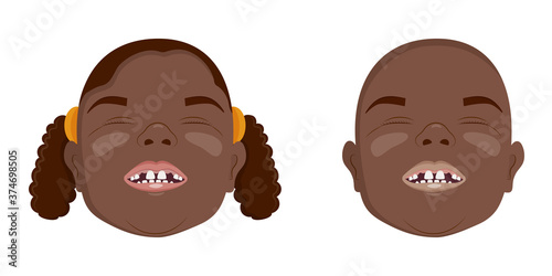 African toothless boys and girls smiling, fallen milk teeth, vector illustration.