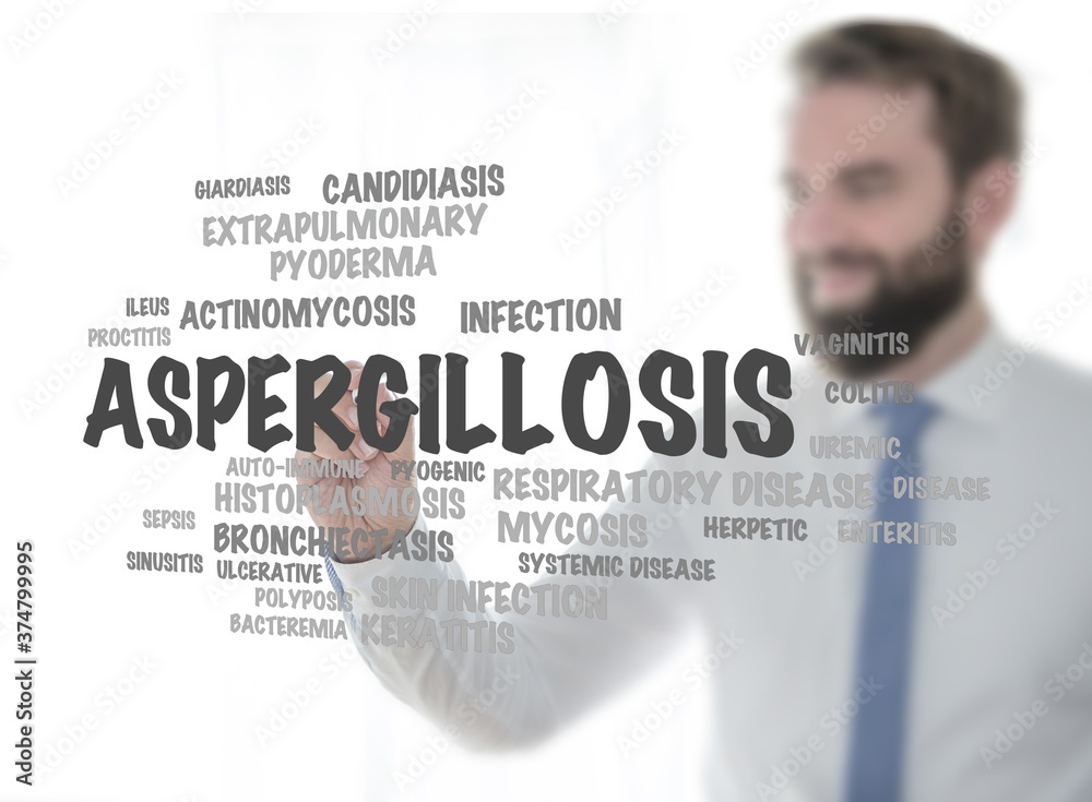 aspergillosis