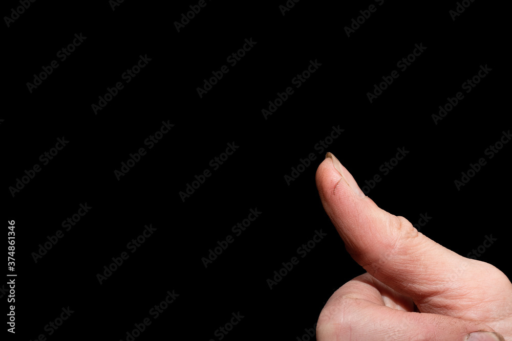 Close-up of an injured finger with an open cut on a black background, copy space. Household trauma concept Close-up of an injured finger with an open cut on a black background, copy space. Household trauma concept