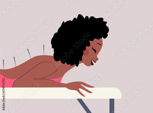 Young woman and acupuncture therapy. Acupuncture body therapy. Asian Chinese traditional medicine treatment. Woman undergoing the procedure on her back in a medical room, salon. Alternative medicine