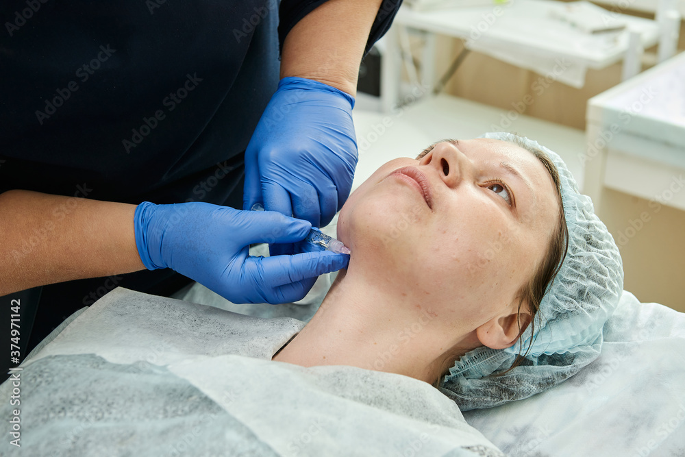 Injections of syringe in the chin of young woman in cosmetic clinic. Injections of syringe in the chin of young woman in cosmetic clinic.