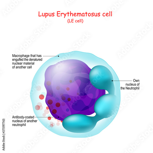 Lupus Erythematosus cell. Structure of LE cell.