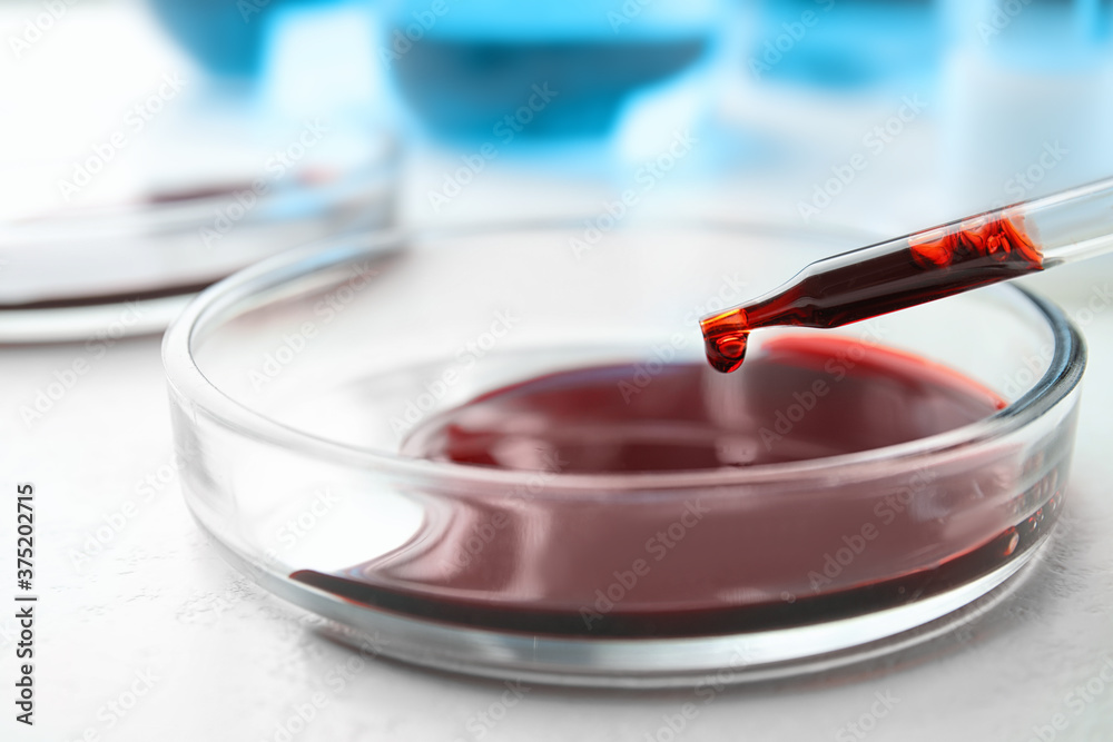 Dripping blood from pipette into Petri dish on table, closeup. Laboratory analysis Dripping blood from pipette into Petri dish on table, closeup. Laboratory analysis
