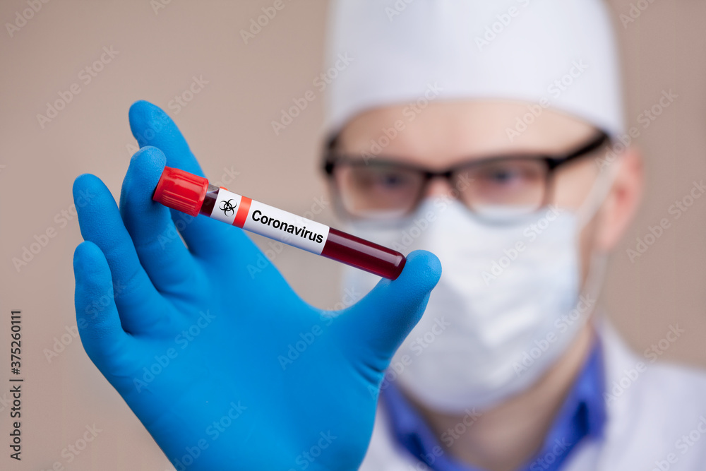 Coronavirus 2019-nCoV Blood Sample. Coronavirus 2019-nCoV Blood Sample.