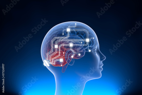 Neuralink surgically implant some computer components onto the surface of your brain to control equipments photo