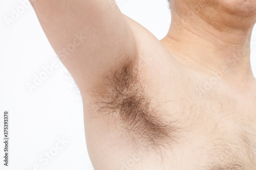 中年男性の体毛