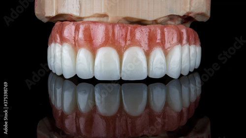 dental prosthesis on a resin model on black glass with reflection