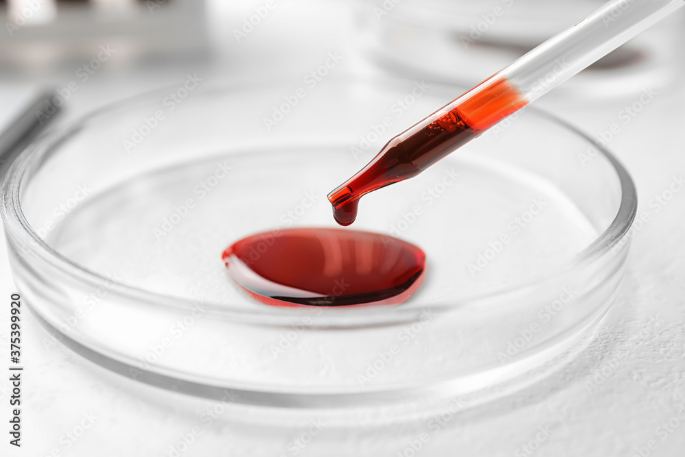 Dripping blood from pipette into Petri dish on table, closeup. Laboratory analysis Dripping blood from pipette into Petri dish on table, closeup. Laboratory analysis