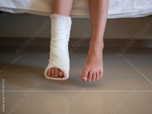 children's leg in a cast. Child with a broken leg